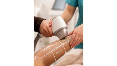 Curs Epilare definitivă cu laser și IPL Sibiu 